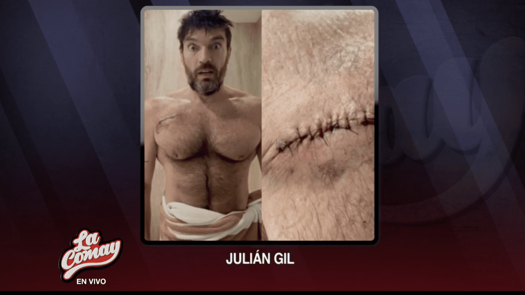 Julián Gil revela que fue diagnosticado con cáncer de piel￼ - TeleOnce TV |  Vívelo