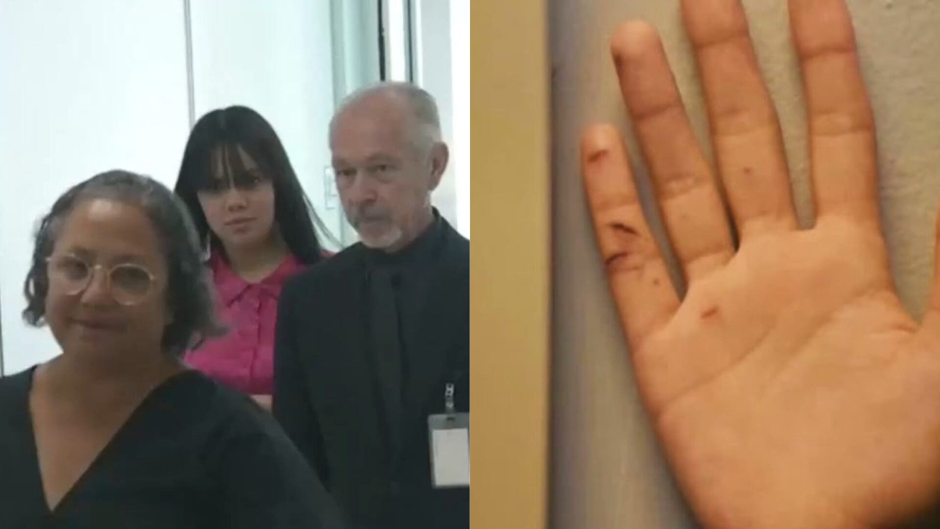 Imagen del artículo de Univision / TeleOnce: Defensa de Anthonieska solicita que foto de su mano cortada sea excluida del juicio